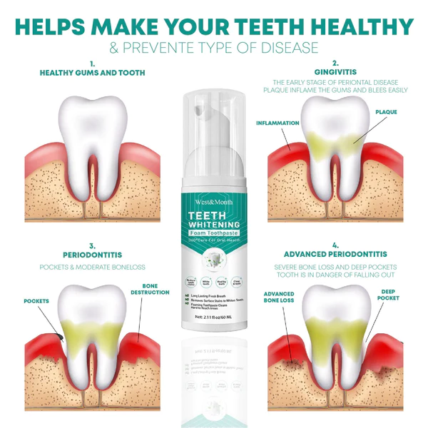 PearlWhite StainOff Mousse Toothpaste