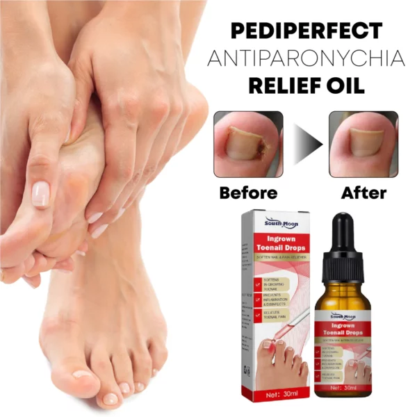 PediPerfect AntiParonychia Relief Mmanụ