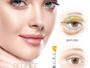 SADOER VitaminC Brightening EyeCream