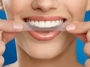 SMILEKIT® 5D Teeth Whitening Strips