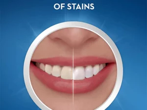 SMILEKIT® 5D Teeth Whitening Strips