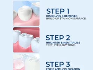 SMILEKIT® 5D Teeth Whitening Strips