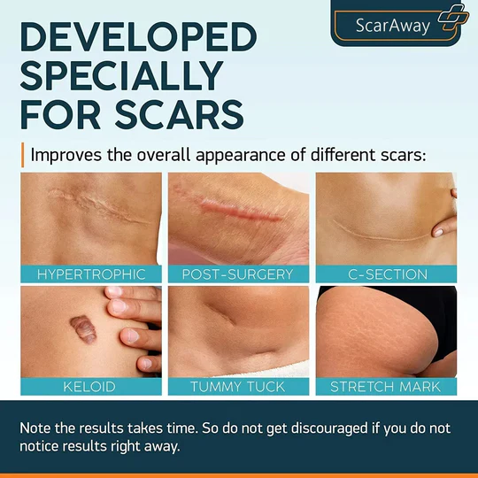 ScarAway® Professional 100 % fortschrittliches Narbengel