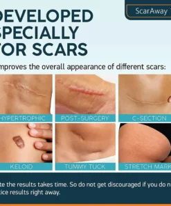 ScarAway Advanced Scar Gel