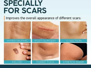 ScarAway PURI Advanced Scar Gel