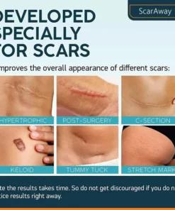 ScarAway® Professional 100% Advanced Scar Gel