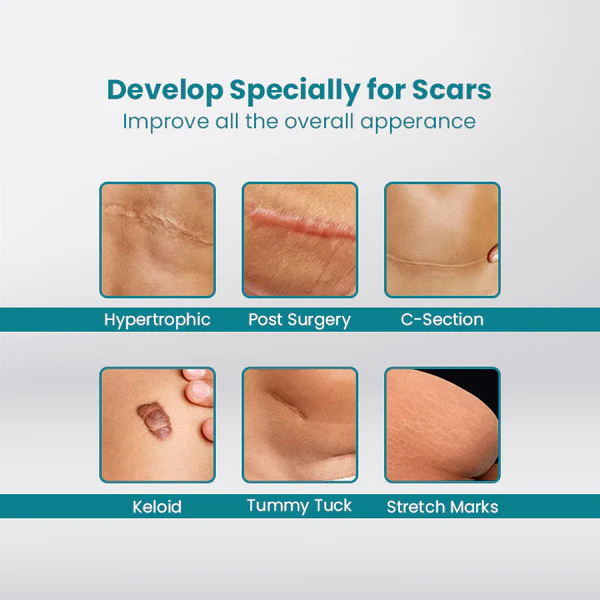 ScarOFF™ Advanced Scar Removal Gél