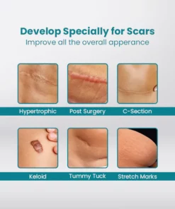 ScarOFF™ Advanced Scar Removal Gel