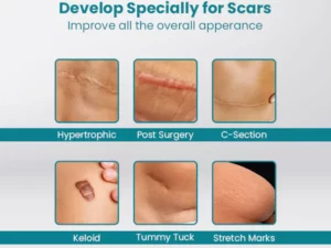 ScarOFF™ Advanced Scar Removal Gel