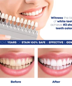 ShinySmile TeethWhitening Essence Pen