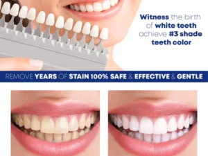 ShinySmile TeethWhitening Essence Pen