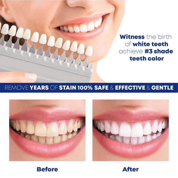 ShinySmile Teeth Whitening Essence Pen