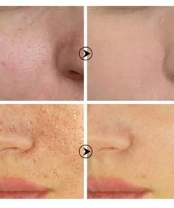 Skin Brightening Anti-Aging Oil Control Anti-Spot Serum