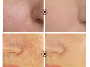 Skin Brightening Anti-Aging Oil Control Anti-Spot Serum