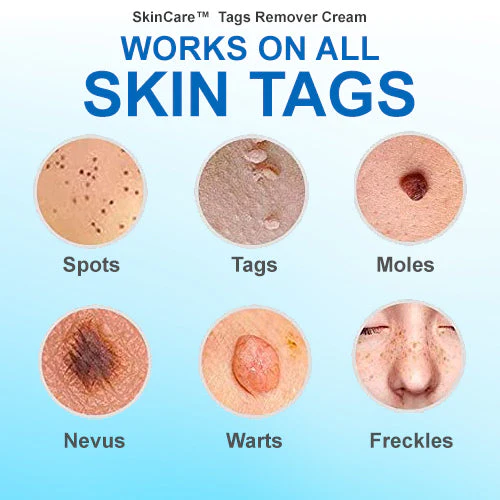 SkinCare™ Tags Remover kremas