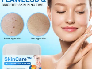 SkinCare™ Tags Remover Cream