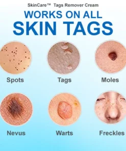 SkinCare™ Tags Remover Cream