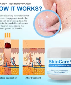 SkinCare™ Tags Remover Cream