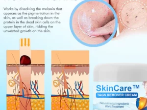 SkinCare™ Tags Remover Cream