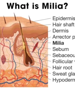 SkinPro Milia Clearing Serum