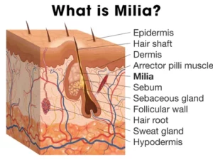 SkinPro Milia Clearing Serum