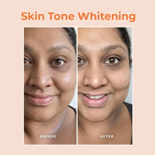 Skinetic™ Papaya Whitening Tiefenpeeling