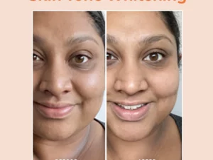 Skinetic™ Papaya Whitening Deep Exfoliator