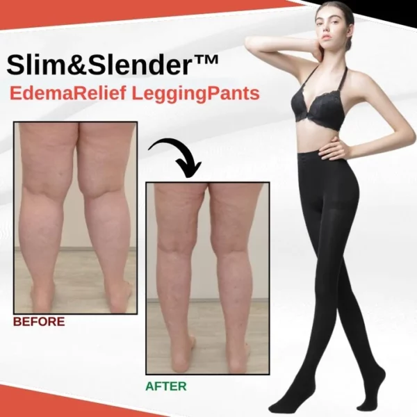 Legginsy Slim&Slender™ przeciwobrzękowe