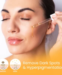 Spot-FREE™ Spot Corrector Turmeric Serum