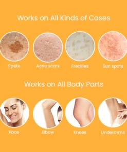 Spot-FREE™ Spot Corrector Turmeric Serum