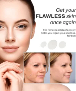 SpotOff SkinTag RemoverPatches