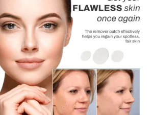 SpotOff SkinTag RemoverPatches