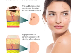 SpotOff SkinTag RemoverPatches