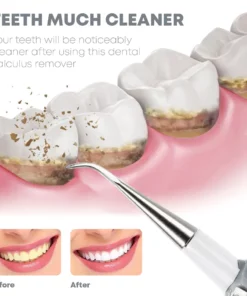 TeethWhitener Ultrasonic Vibration Cleaner
