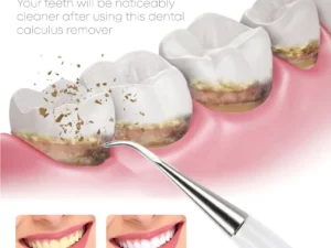 TeethWhitener Ultrasonic Vibration Cleaner