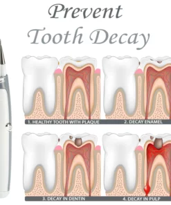 TeethWhitener Ultrasonic Vibration Cleaner