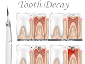 TeethWhitener Ultrasonic Vibration Cleaner