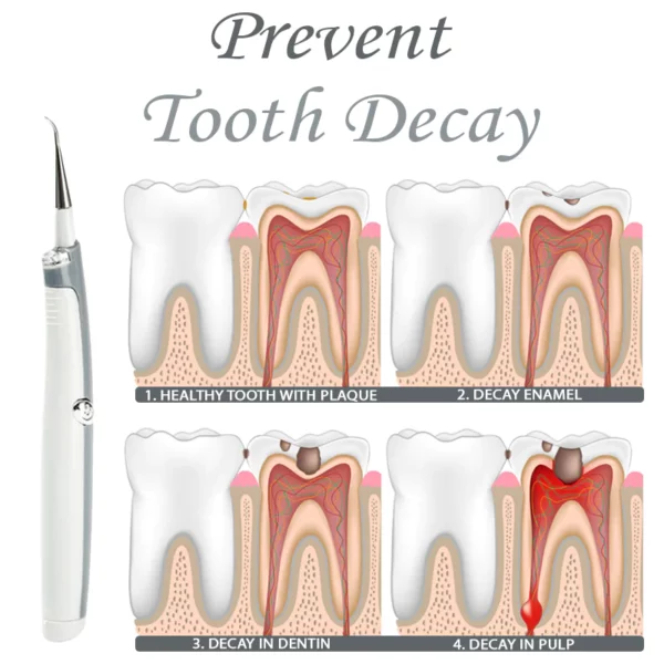 Clareador de dentes com vibração ultrassônica