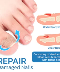 ToeHeal Paronychia Relief Patch