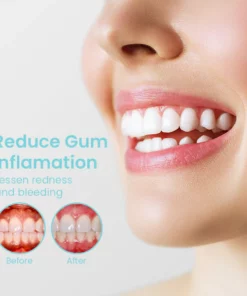 TotalCare™ Teeth Aid Mouthwash