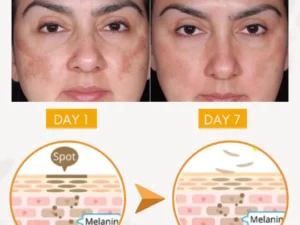 TripleAction BlemishSkin Corrector Serum