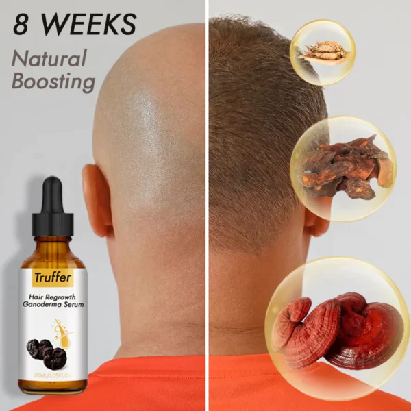 Truffer Pagtubo Pag-usab sa Buhok Ganoderma Serum