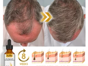 Truffer Hair Regrowth Ganoderma Serum