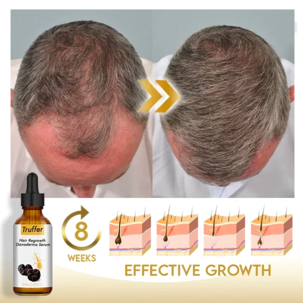 Truffer Haarwachstum Ganoderma Serum