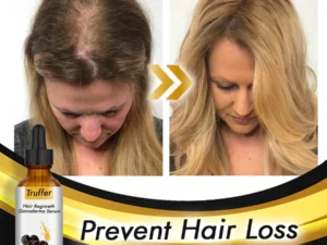 Truffer Hair Regrowth Ganoderma Serum