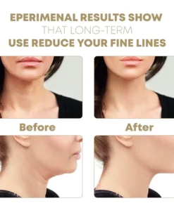 Ultrasonic FacialLifting Beauty Instrument