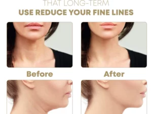 Ultrasonic FacialLifting Beauty Instrument
