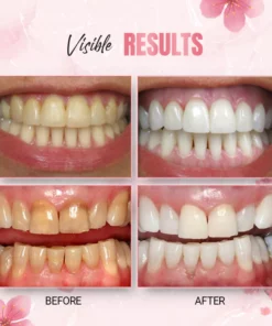 WhiteLab™ Teeth Stain Removal Whitening Strips