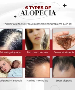 ქალების 100% ვეგანური კოფეინის საწინააღმდეგო ალოპეცია სწრაფი ზრდის თმის ზეთი