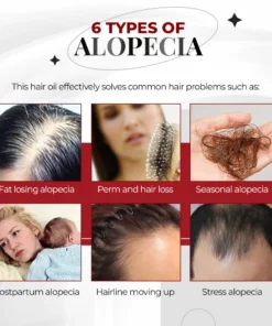 Mujeres 100% Vegan Cafeína Anti Alopecia Aceite Capilar Crecimiento Rápido